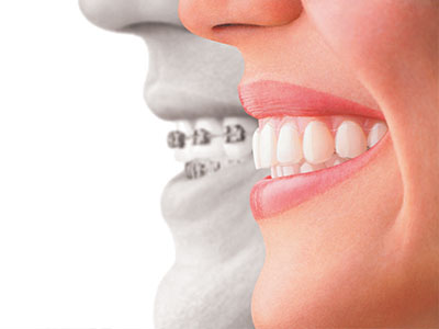 The image depicts a split-screen comparison of a person s face with a dental implant on one side, highlighting the difference in appearance before and after treatment.