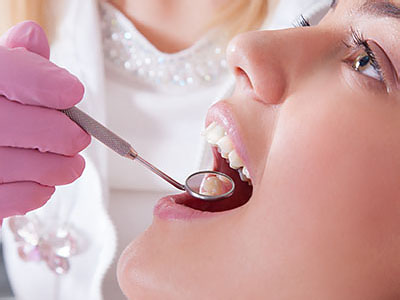 A dental professional using a dental tool on a patient s mouth during a dental procedure.