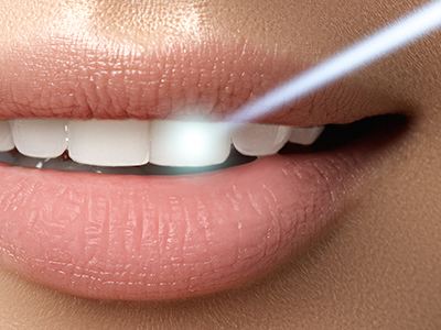 The image features a close-up view of a person s mouth with a focus on their teeth and lips, with a noticeable blue light illuminating the area around the mouth, possibly indicating some sort of dental care product or technology being used.